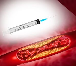 Cholestérol: une injection pour en finir avec les comprimés à vie?