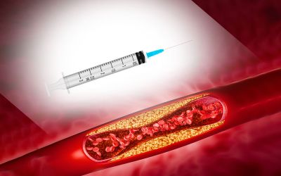 Cholestérol: une injection pour en finir avec les comprimés à vie?