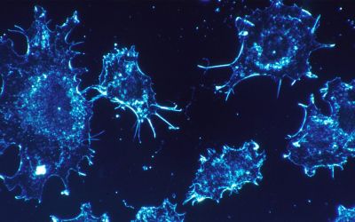 Cancer au Liban : armes modernes, tueur toujours en liberté
