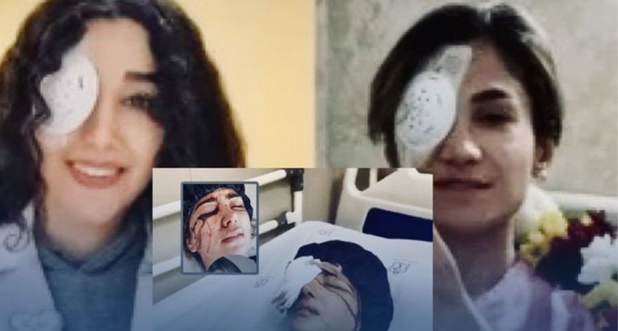 Iran: le pouvoir qui vise les yeux, ou la guerre faite au regard