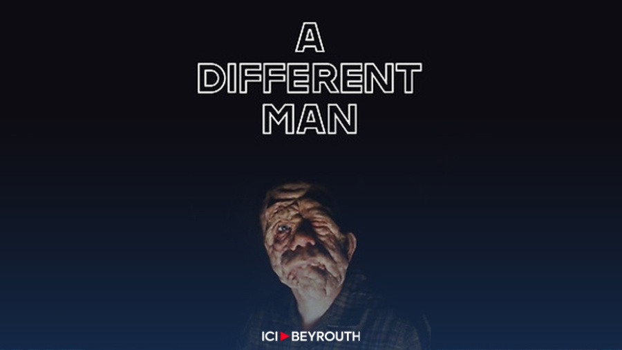 «A Different Man»: beauté et handicap redéfinis